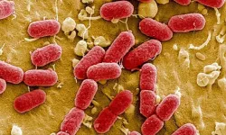 Almanya'da E. Coli salgını can aldı