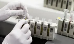 Almanya'dan AIDS, verem, sıtma mücadelesine destek