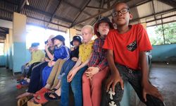 Kara kıtanın 'albino' çocuklarının yüzünü Türk Diyanet Vakfı güldürdü