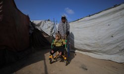 İsrail saldırısında yaralanan 4 yaşındaki Kamer, yeniden yürüyebilmenin hayalini kuruyor