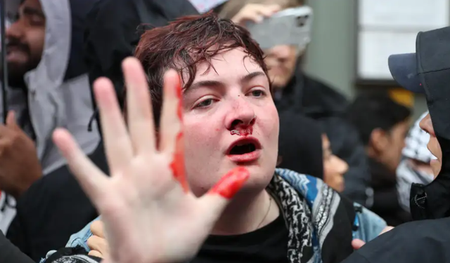 İrlanda, Berlin Polisine Tepki Gösterdi