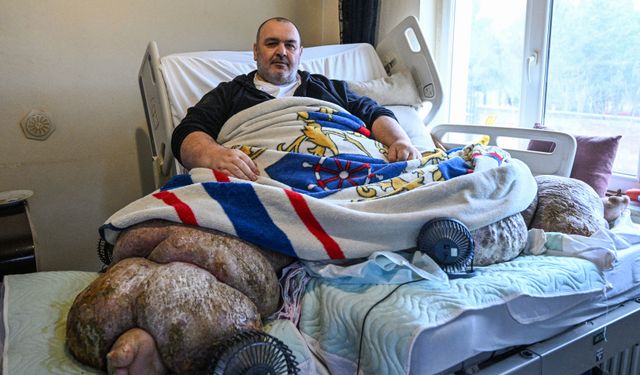 Kayseri'de yaklaşık 300 kiloluk fil hastası kişi, özel ekiple evinden çıkarılıp hastaneye sevk edildi